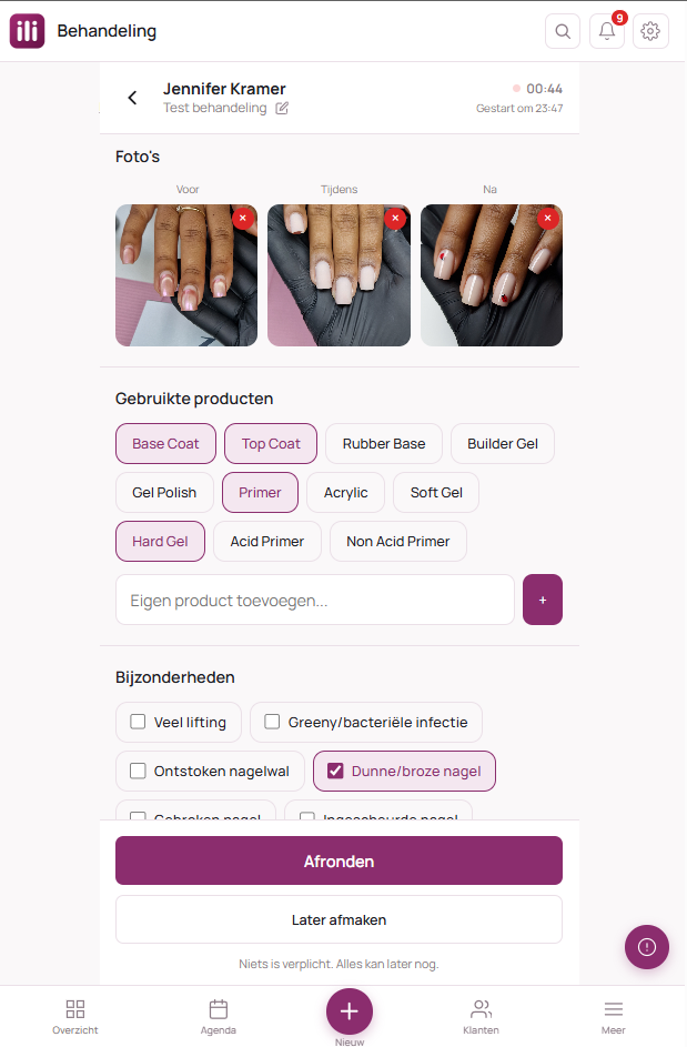 Afspraak in Nailify met de knop Start de behandeling