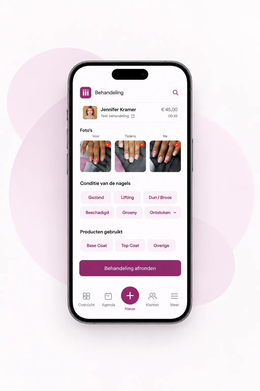 Het behandelscherm van Nailify op een telefoon: foto's voor, tijdens en na, conditie van de nagels, gebruikte producten en de knop Behandeling afronden
